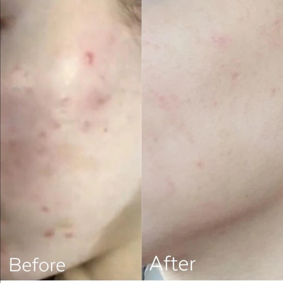 Three Ships Dew Drops Mushroom Hyaluronic Acid + Vitamin C Serum - Picture 4 of 5